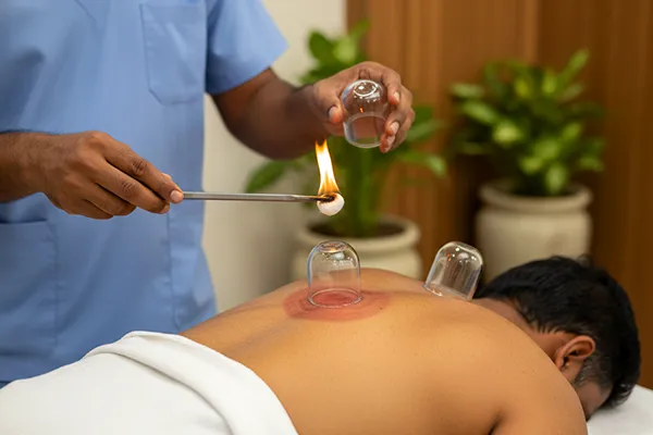 Fire Cupping
